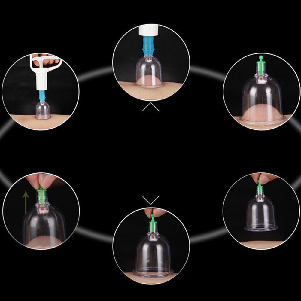 24 Vacuum Cupping Cups Kit Hom - Home Improvement Kit ulasan dan harga